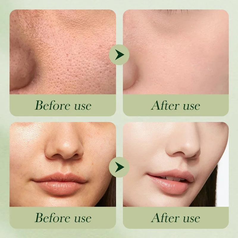 Your Complete Glow-Up Skincare Routine