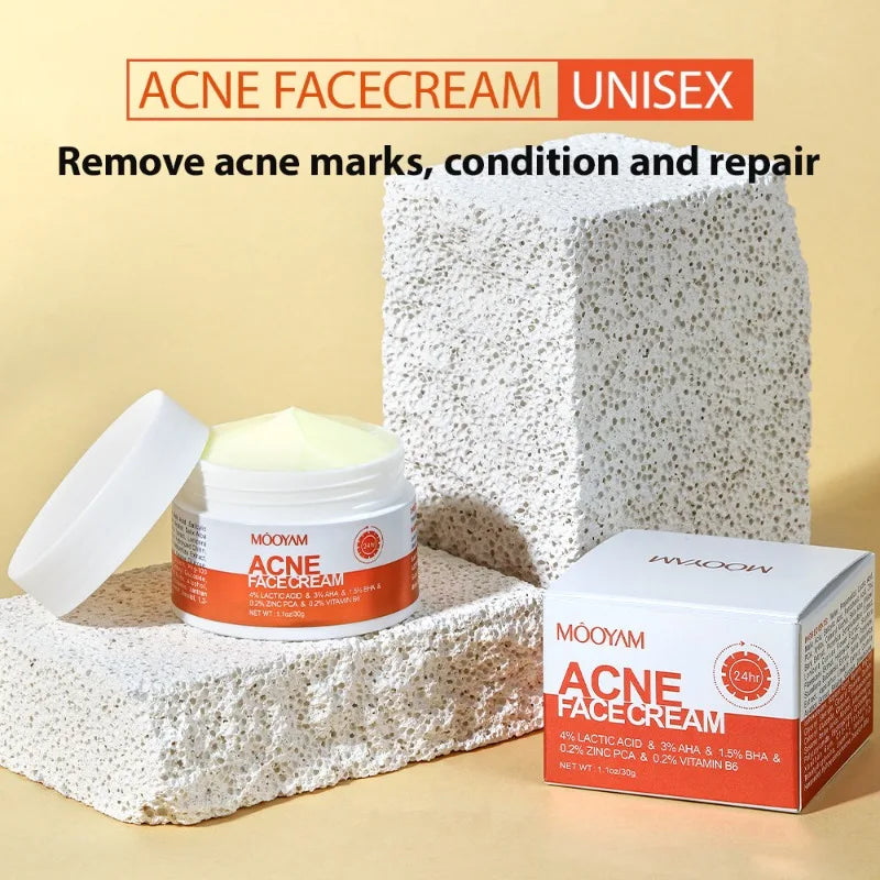 Clear Skin Salicylic Acid Treatment Cream
