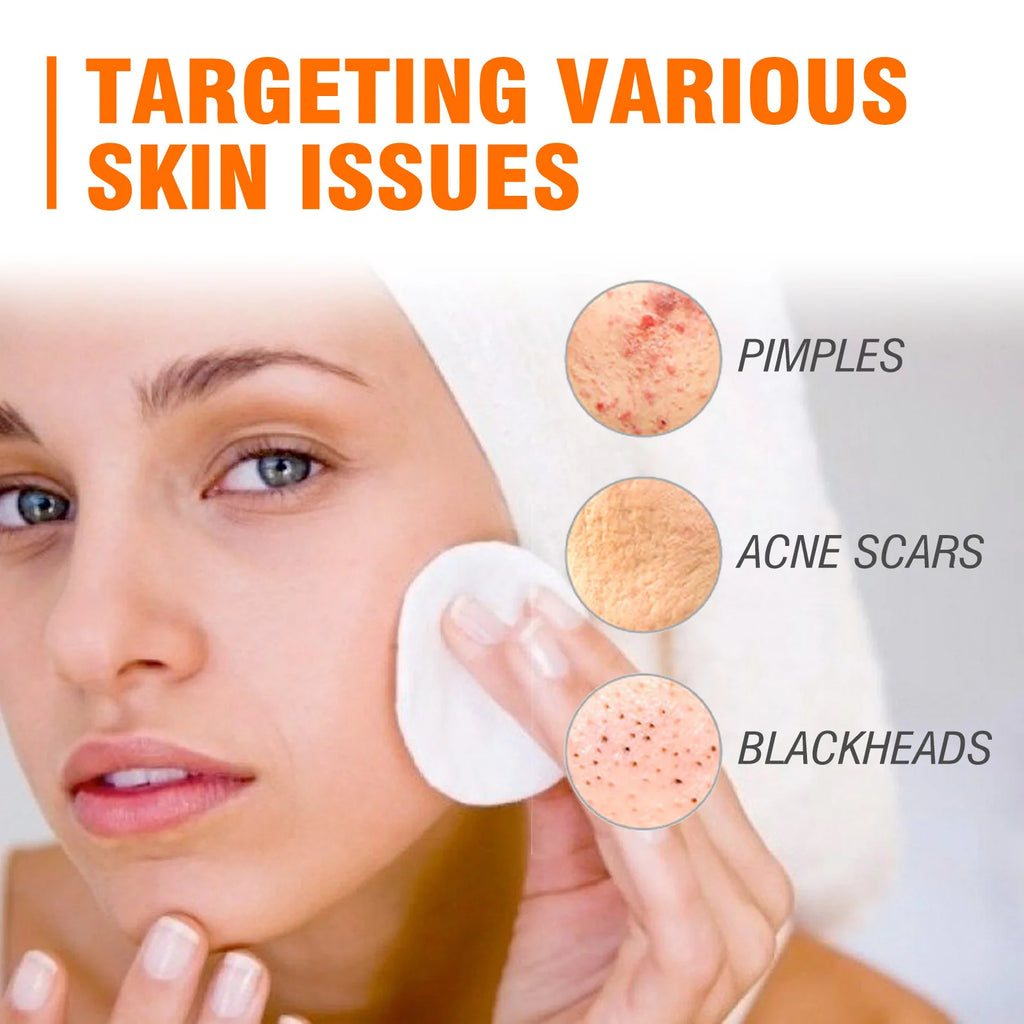 Salicylic Acid Deep Cleansing Face Mask