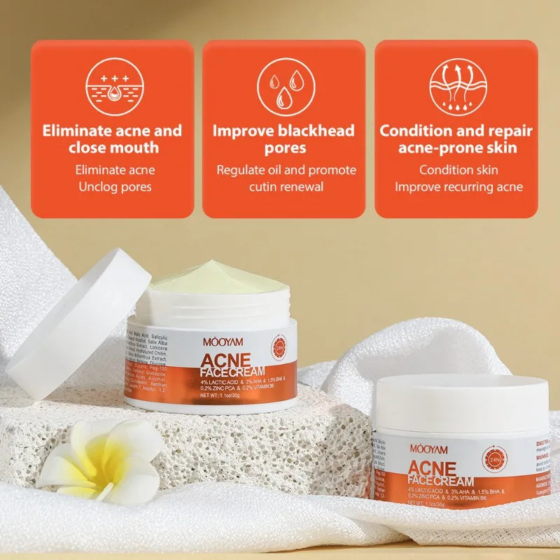 Clear Skin Salicylic Acid Treatment Cream
