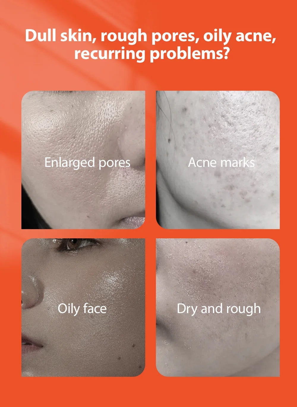 Clear Skin Salicylic Acid Treatment Cream
