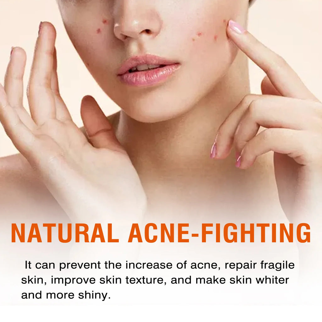 Salicylic Acid Deep Cleansing Face Mask
