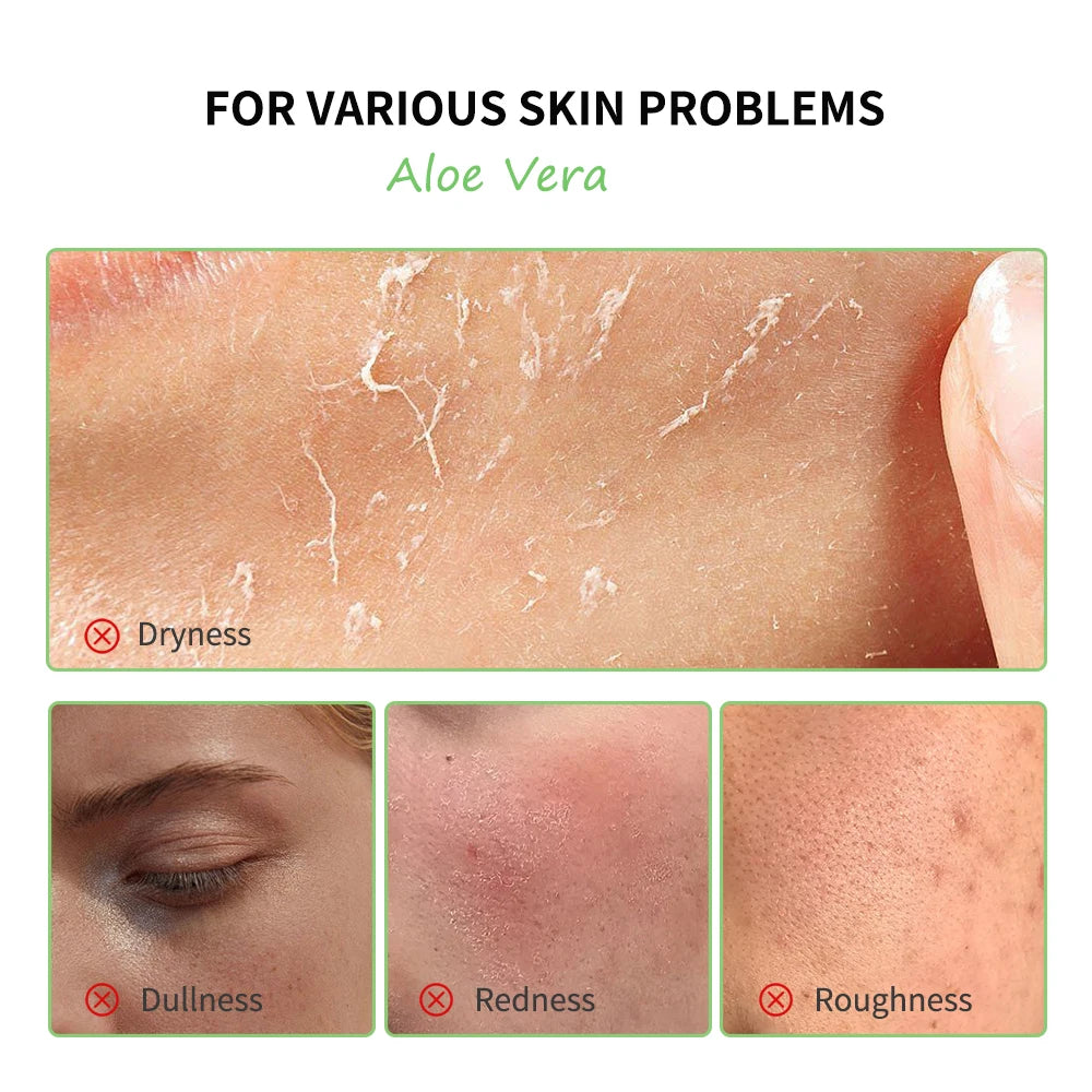 Aloe Vera Complete Skincare Set — 6 Pieces