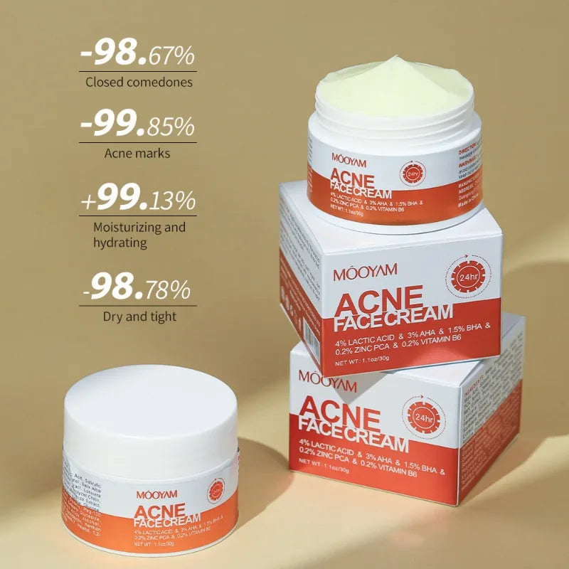 Clear Skin Salicylic Acid Treatment Cream